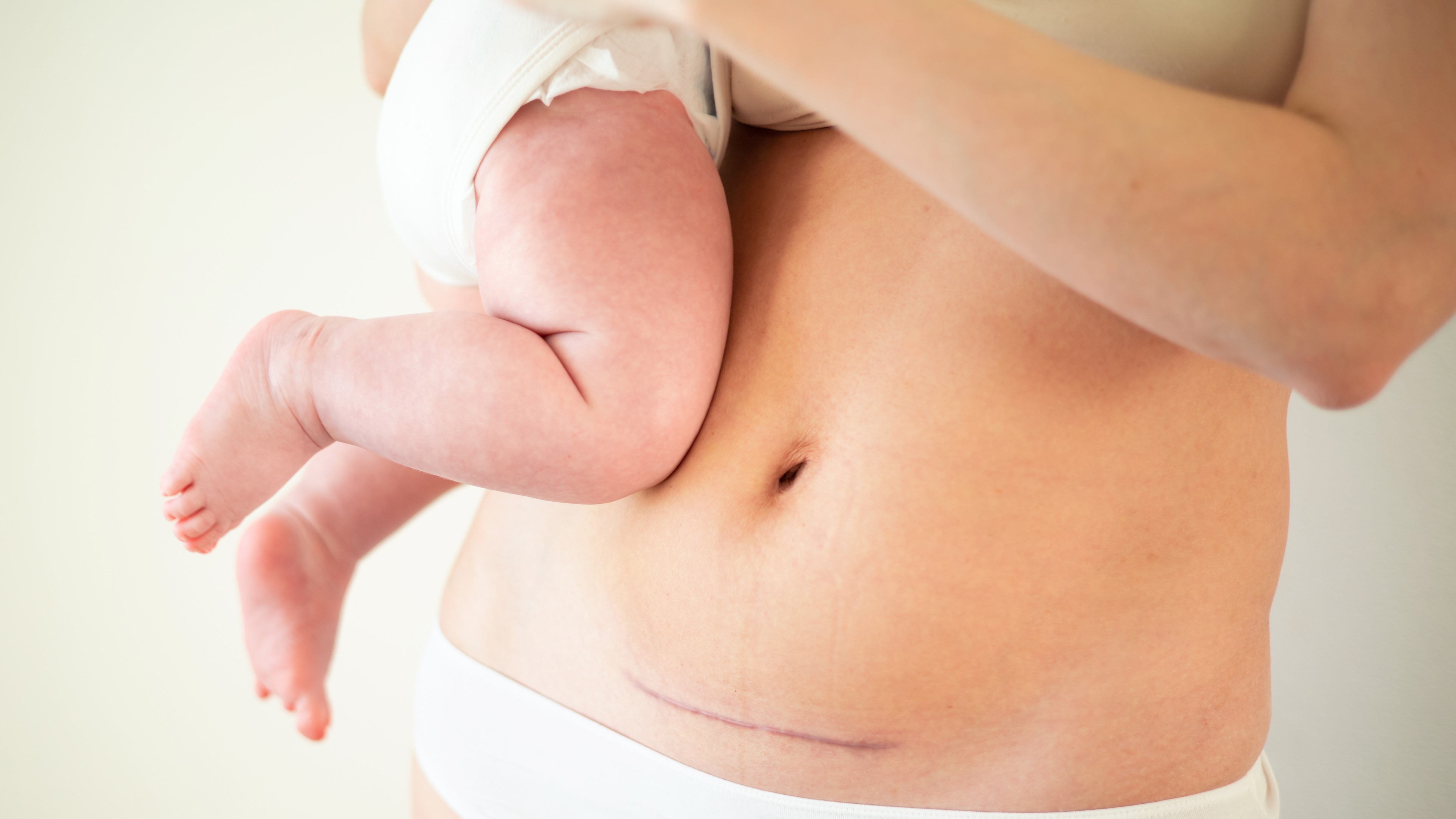 Spotlight on Nutritional Management for C-Section & Recovery 